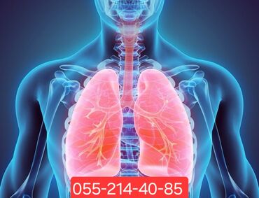 Tibbi avadanlıq: Tibbi Oksigen Balonu icarəsi və satışı Xəstələrin ev şəraitində — 6