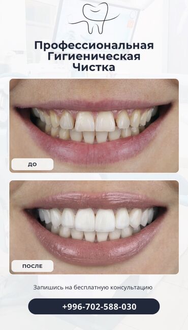 художественная реставрация зубов композитными материалами: Врачи, Клиника | Стоматолог