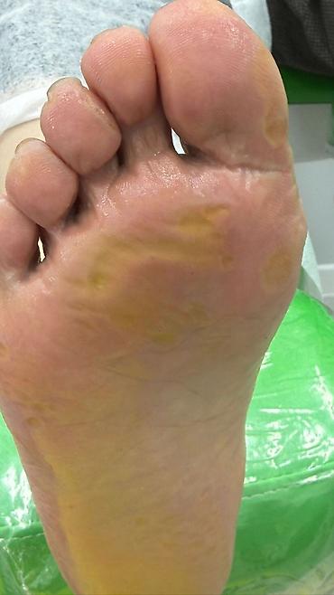 Маникюр: Коррекция вросших ногтей, Маникюр, Педикюр, Услуги подолога, С выездом на дом, Консультация, Одноразовые расходные материалы — 12