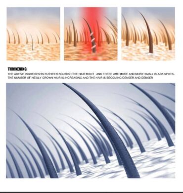 Уход за телом: США Спрей для роста волос Против выпадения волос и стимулирующий — 12