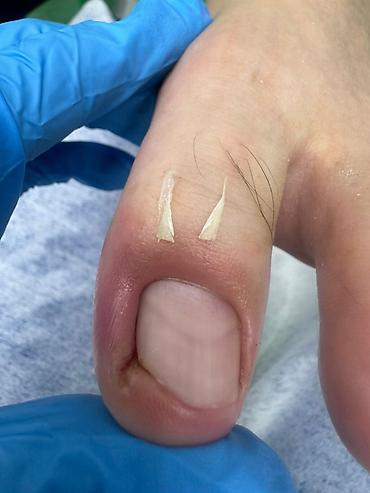 Маникюр: Коррекция вросших ногтей, Маникюр, Педикюр, Услуги подолога, С выездом на дом, Консультация, Одноразовые расходные материалы — 3