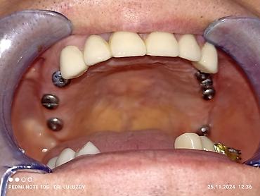 Медицинские услуги: Клиника | Стоматолог | Протезирование — 13