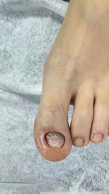 Маникюр: Ремонт сломаных ногтей, Наращивание ногтей, Донаращивание ногтей, Услуги подолога, Маникюр, Педикюр, Консультация, Одноразовые расходные материалы — 9