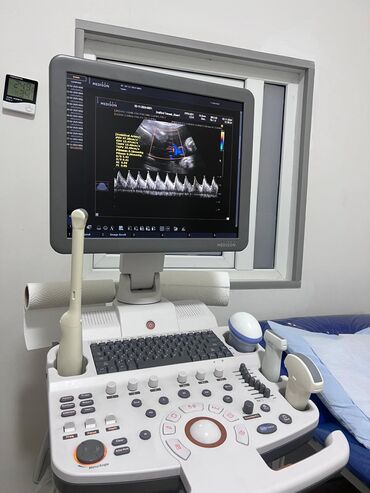 Opel: Medison rəqəmsal USM aparatı – 2D/3D/4D rəngli doppler Xüsusiyyətlər