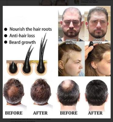 Уход за телом: США для роста волос для роста бороды от облысения от алопеции от — 5