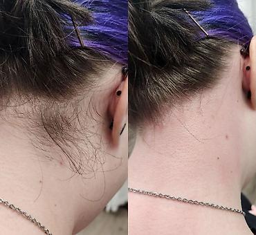 Эпиляция: Восковая депиляция для женщин и мужчин Подмышки - 500 сом — 6