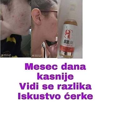 Nega kože: Aknelim gel 30ml – 100% delotvoran saveznik protiv akni Iskoristite — 8