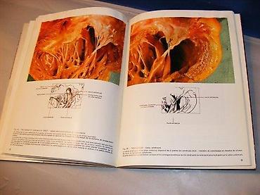 range rover igracka: Anatomie du coeur atlas photographique Broché– 1965 de Tricot R. Ragot — 2