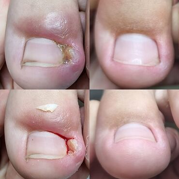 Маникюр, педикюр: Ремонт сломаных ногтей, Снятие, Укрепление ногтей, Услуги подолога, Одноразовые расходные материалы, Консультация, С выездом на дом — 14