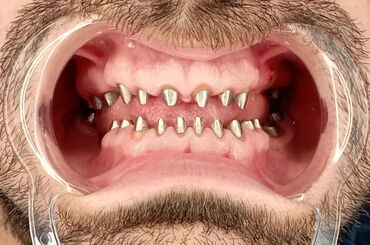 Stomatologiya: 💫Ramazan ayı ilə əlaqədar Kampaniya✨🌟⭐💫 🌊🔥Diş Həkimi 🔥🌊 Qiymətləri — 14