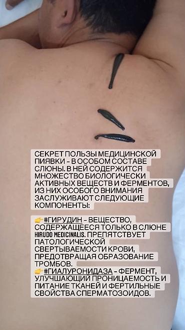 простатит: Врачи, Клиника | Гирудотерапевт | Диагностика, Консультация, Лечение пиявками — 6