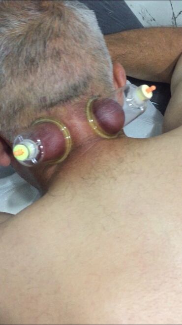 Kosmetologiya: Bəylər üçün = Lazer Epilasiyasi✅Hicama və — 15