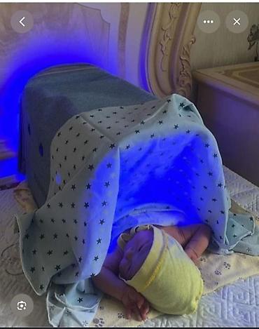 Балдар дүйнөсү: Домашний фототерапевтический бокс для новорождённых (свет для снижения — 1