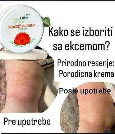Ortopedski dušeci i jastuci: Limes proizvodi Porudzbine,saradnja postani moj kupac,saradnik — 181