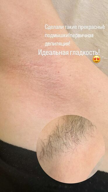 Эпиляция: Я мастер Ася 🍯 С опытом 3 года 🤝 Шугаринг Ламинирование бровей и — 11