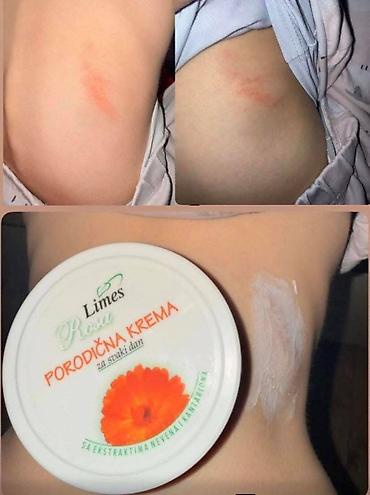 Nega kože: Ide leto,deca su u majicama i sorcicima. Padovi sa — 2