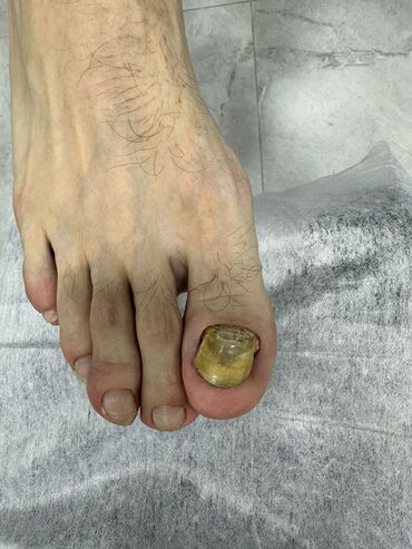 Маникюр, педикюр: Наращивание ногтей, Гель лак, шеллак, Укрепление ногтей, Услуги подолога, Маникюр, Педикюр, Консультация, Одноразовые расходные материалы — 5