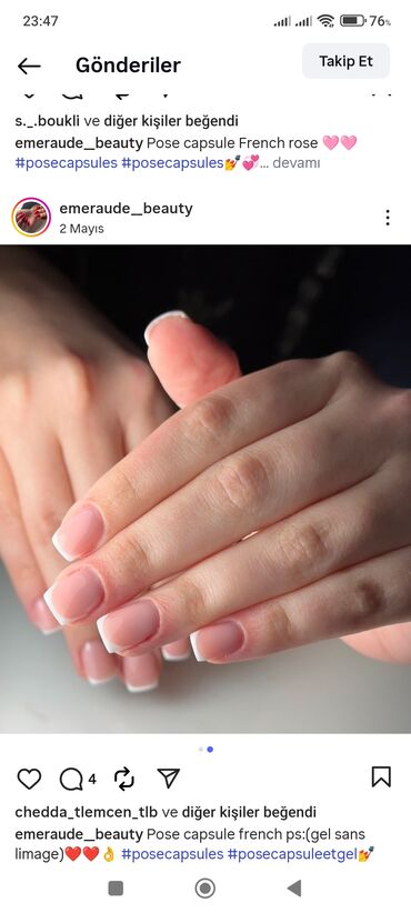 Manikür, pedikür: Manikür, Dırnaq qaynağı — 7