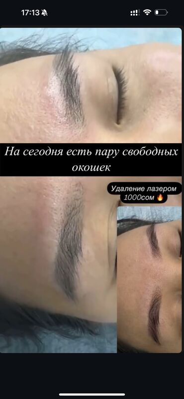 Перманентный макияж: АКЦИЯ !АКЦИЯ! Новый метод удаления Сейчас по акции Лазерное удаление — 4