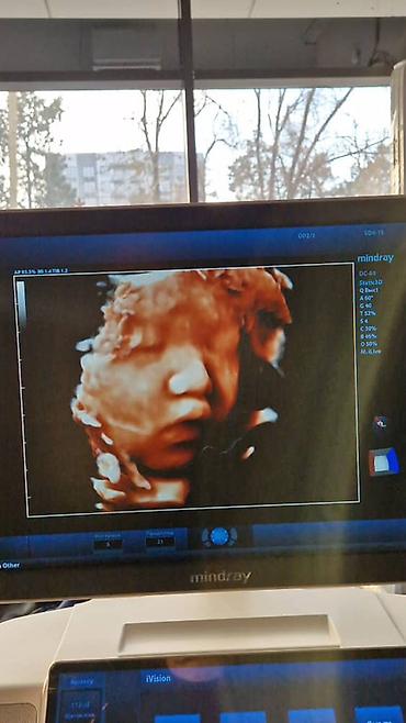 Медицинское оборудование: Продаётся УЗИ аппарат экспертного класса Mindray DC-80 X-INSIGHT — 11