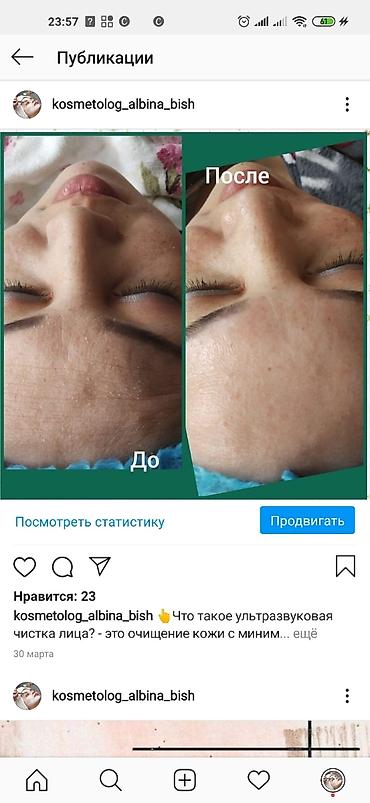 подарок подруге на день рождения в Бишкек: Акция!! Ультразвуковая чистка лица ( для мужчин и женщин) мультимаска