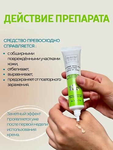прыщи: Щи Фей Ши - китайский крем для лица, эффективно удаляет прыщи и — 4