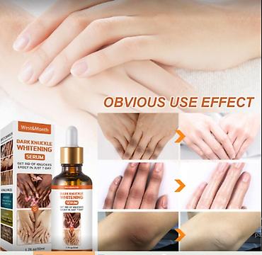 Уход за телом: США Отбеливающее средство для кожи MatureGirl, осветляющее средство — 8