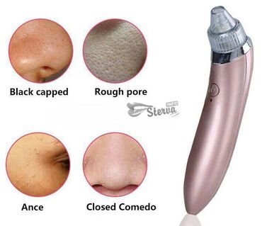 beauty skin care specialist: Yeni vakuumlu aparat uzu temizliyir.Akne,sizanaq,qara noqteleri yox