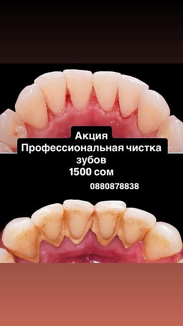 уста ремонт: Профессиональная чистка зубов Акция: профессиональная гигиена полости — 1