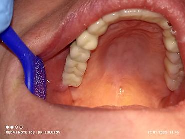 Медицинские услуги: Клиника | Стоматолог | Протезирование — 6