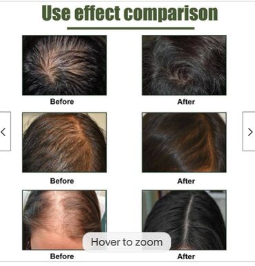 ❄️ С️ША Сыворотка для роста волос и бороды blusoms folligrow