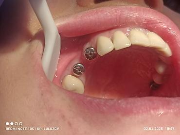 Медицинские услуги: Клиника | Стоматолог | Протезирование — 3