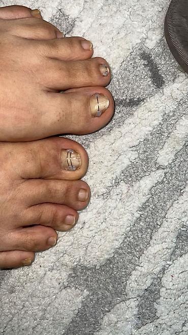 Маникюр: Коррекция вросших ногтей, Педикюр, Услуги подолога, Консультация, Одноразовые расходные материалы — 9