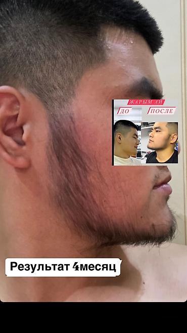 Уход за телом: Рост борода и волосы Миноксидил ультра 15% оригинал✅из Турции🇹🇷 — 8