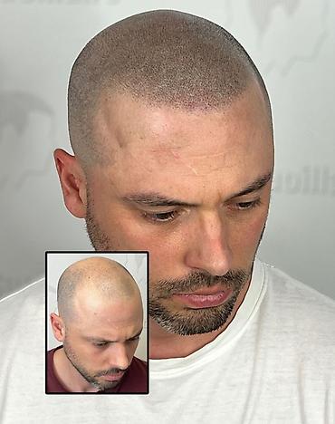 mühafizə xidməti: Tatto nökte atişiylariyla tük effekti yaradib keçelliyi örten — 1