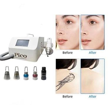 Ostali aparati za negu lica: Piko sekundni laserski aparat skidanje tetovaze za estetske tretmane — 7