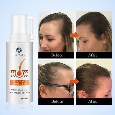delay spray: Спрей от выпадения и для роста волос — 2