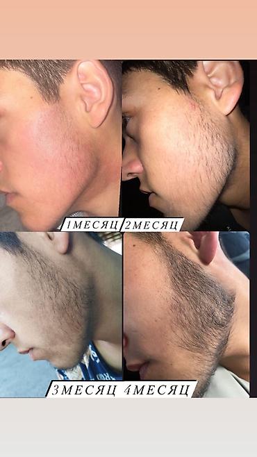 Уход за телом: Рост борода и волосы Миноксидил ультра 15% оригинал✅из Турции🇹🇷 — 13