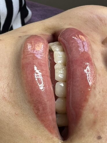 Косметология: Косметология, Ботокс, Биоревитализация, Ботулинотерапия, Консультация, Гипоаллергенные материалы, Сертифицированный косметолог — 42