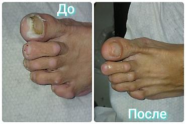 Маникюр: Дизайн, Донаращивание ногтей, Наращивание ногтей, Маникюр, Педикюр, Требуются модели, С выездом на дом, Одноразовые расходные материалы — 11