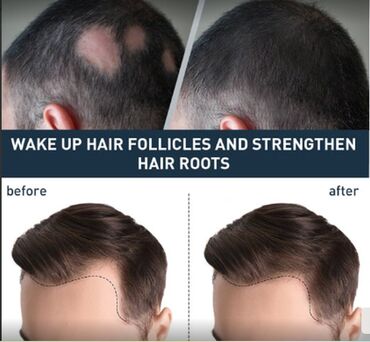 Уход за телом: США Жидкость для роста волос на теле и голове Сильное восстановление — 6