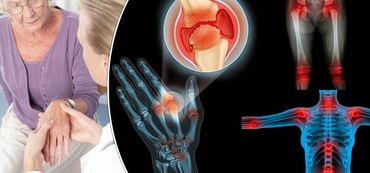 Уход за телом: Бишофит от чего помогает. опорно-двигательного аппарата — 2