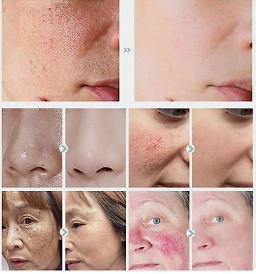 Уход за телом: ❄️ США СЫВОРОТКА ДЛЯ КОЖИ ОТБЕЛИВАНИЕ цена-450сом\флак-розниц — 8