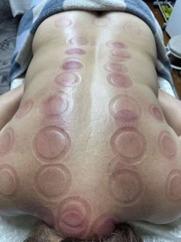 Массаж: Массаж | Спортивный массаж | Защемление седалищного нерва, Кифос, лордоз, Межпозвоночная грыжа | С выездом на дом — 2