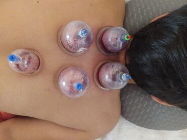 Hicama, zəli: Hicama, quru və yaş vakuum masajı, həmçinin zəli ilə müalicə xidməti — 8