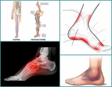 Другая мужская обувь: Стельки ортопедические(специализированные) от плоскостопия! Для — 23