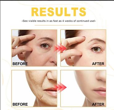 Уход за телом: США Крем Ночной Ретинол Отбеливание увлажнение удаление морщин т — 7