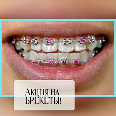 Dentist | Braces systems, plates
