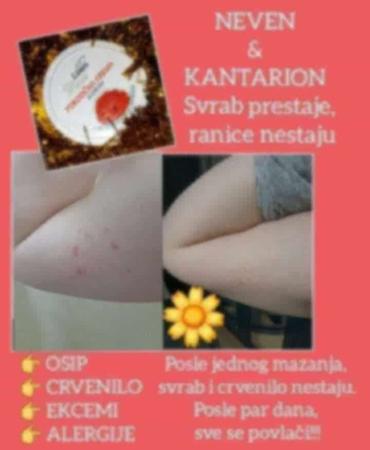 Nega kože: Limes Rosa Porodična krema – kantarion i neven Višenamenska krema za — 8