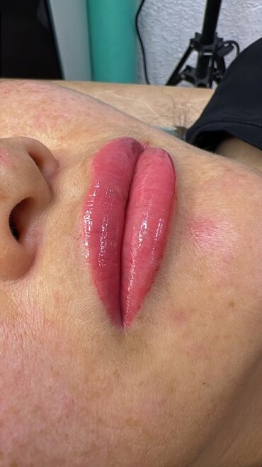 Косметология: Косметология, Биоревитализация, Ботокс, Демодекоз, Гипоаллергенные материалы, Консультация, Сертифицированный косметолог — 31